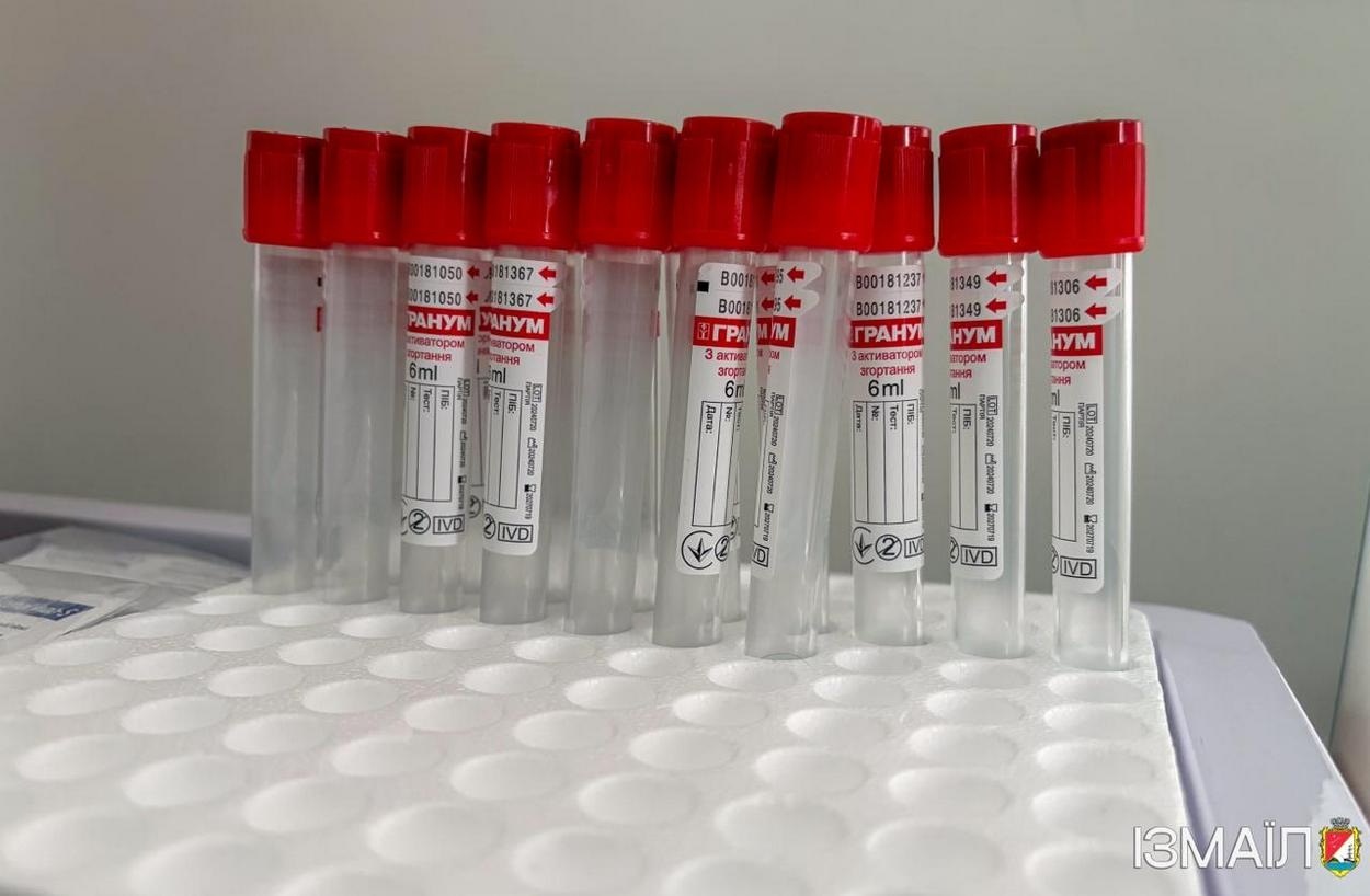 В Ізмаїлі стартувала програма безкоштовного скринінгу здоров’я тих, кому вже понад 40 років